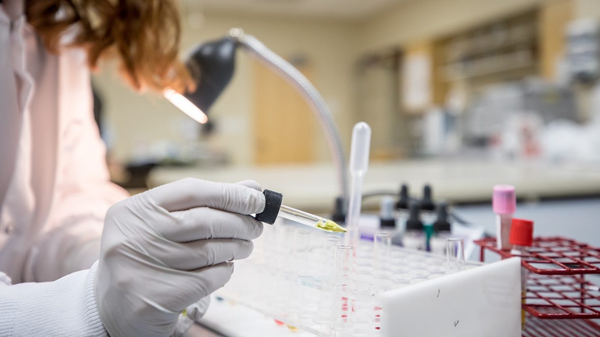 Gloved hand holding a dropper with yellow liquid over test tubes in a clinical laboratory setting.