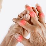 asian woman hand suffering from joint pain with gout in finger