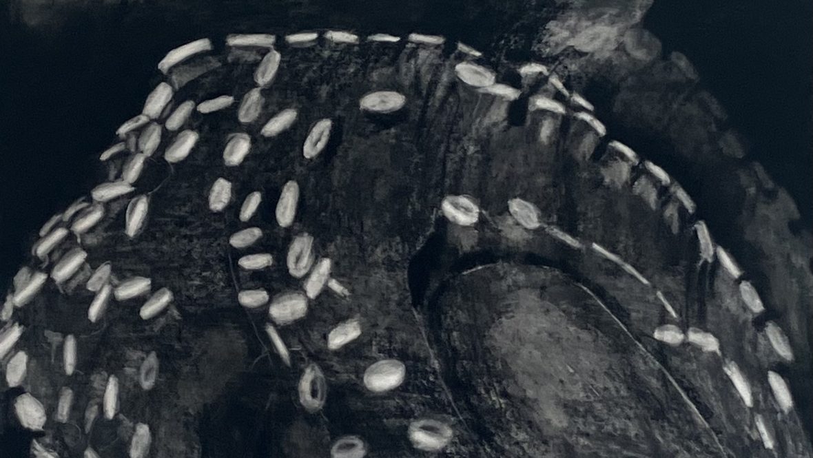Dark, close-up artwork of overlapping octopus tentacles, with rows of pale suction cups standing out against the nearly black forms.